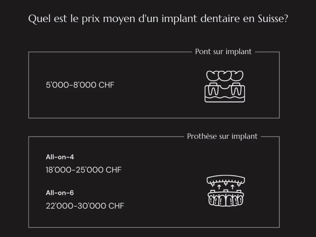 Combien Coute Un Implant Dentaire à Genève