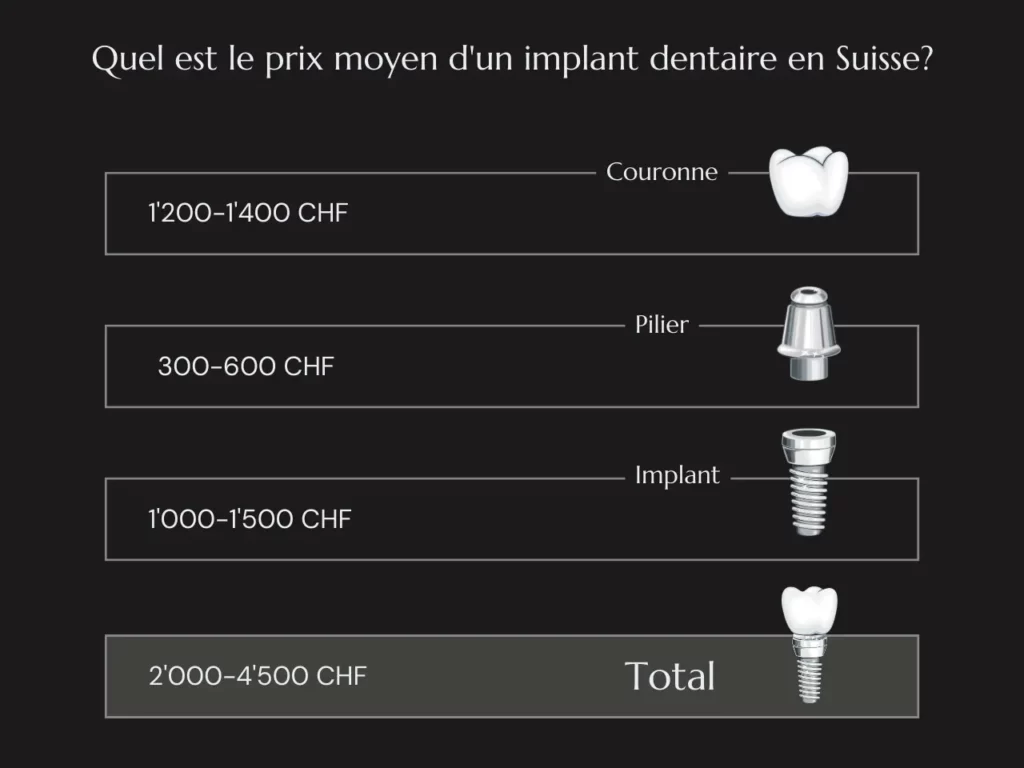 Prix Implant Dentaire Suisse