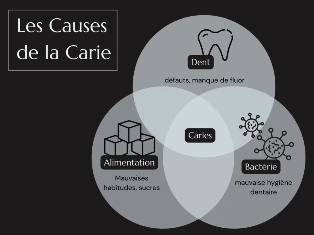 Les Causes de la carie dentaire