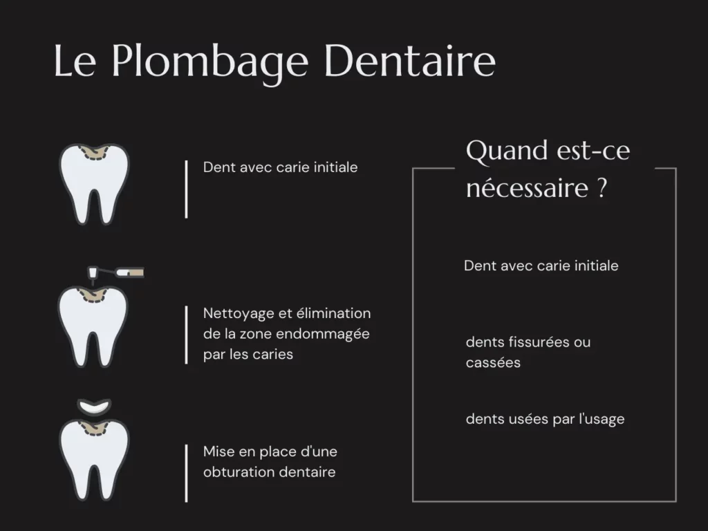 Plombage Dentaire C'est quoi