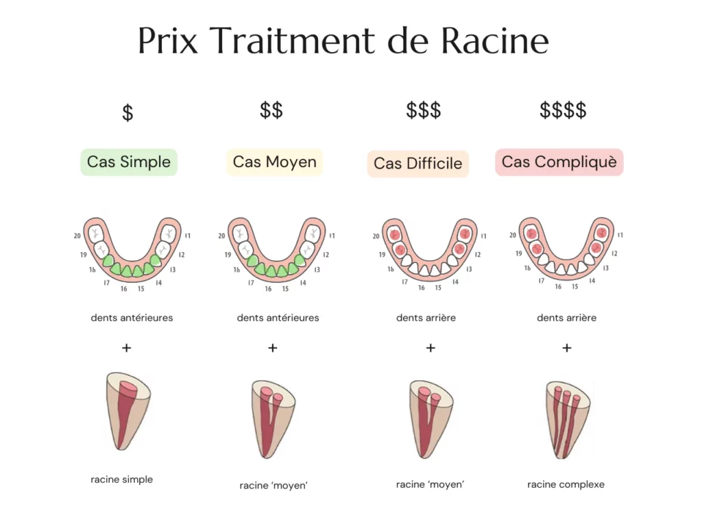 Prix Traitment de Racine