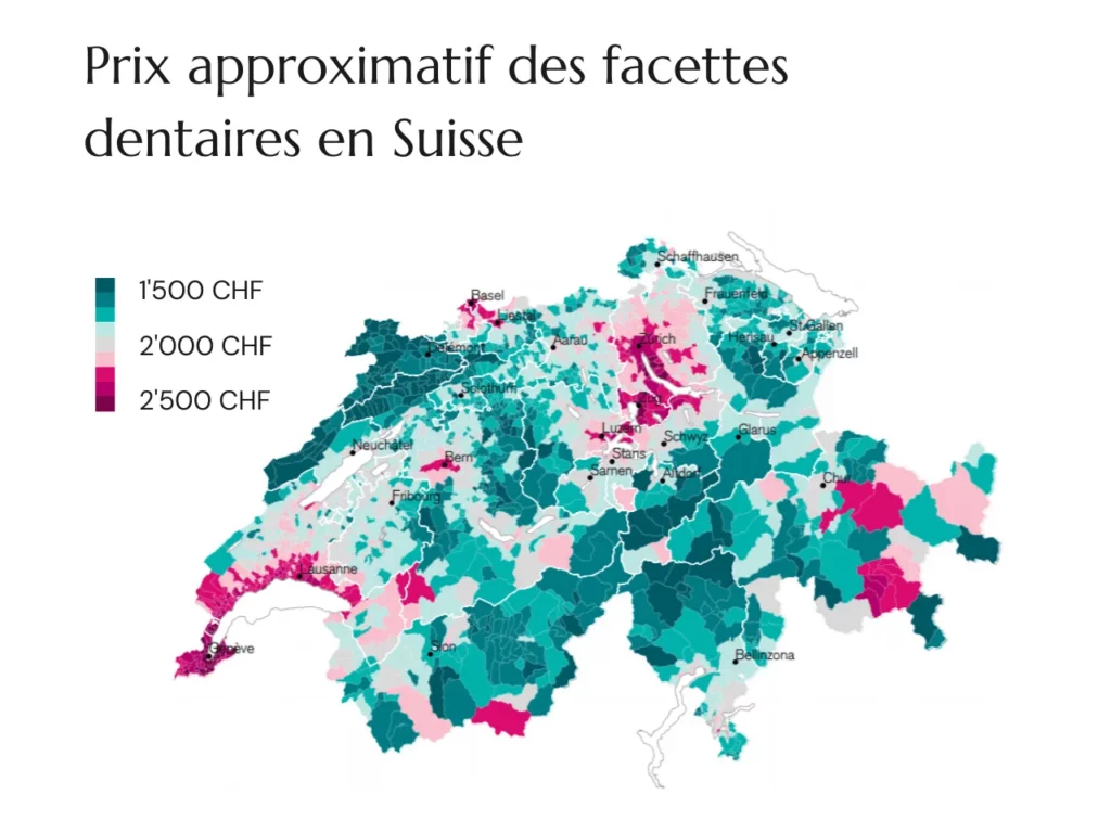 Prix facettes dentaires cantons suisses