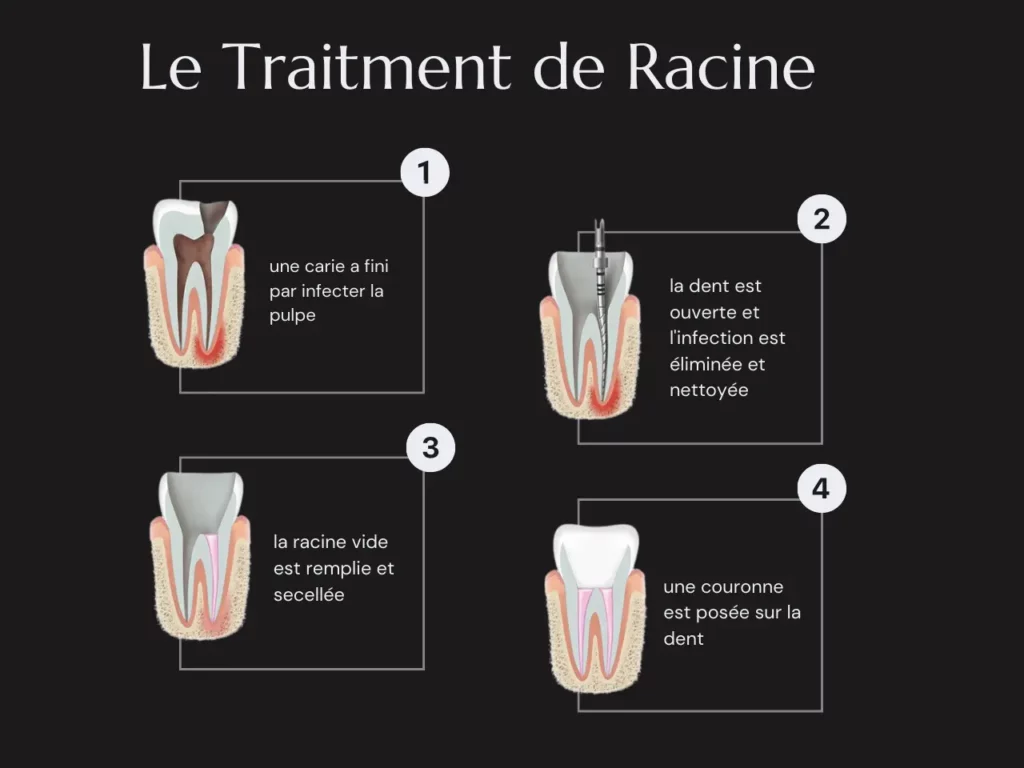 Qu'est-ce que le traitement de racine