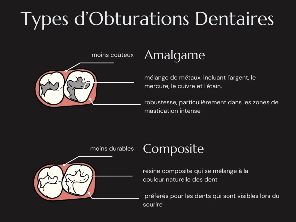 Types des Obturations Dentaires